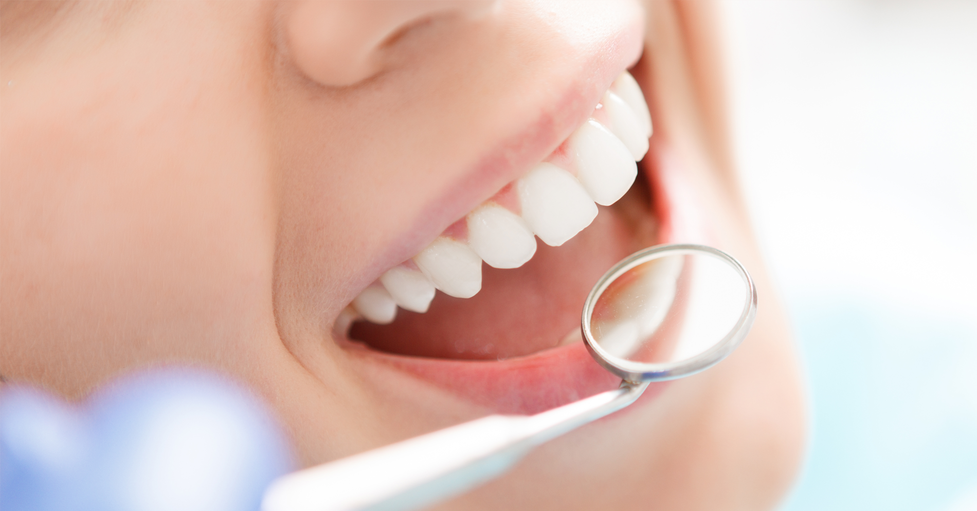 Same-day Dental Care in Fort Lauderdale